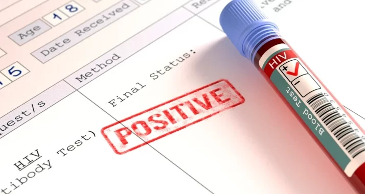 hiv-positive-test